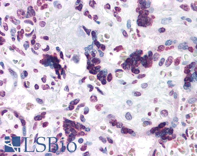 Anti-CARD14 / CARMA2 antibody IHC of human placenta. Immunohistochemistry of formalin-fixed, paraffin-embedded tissue after heat-induced antigen retrieval. Antibody LS-B4697 concentration 5 ug/ml.