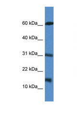 CARD17 antibody LS-C135943 Western blot of Jurkat Cell lysate. Antibody concentration 1 ug/ml.