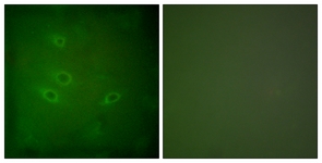 Immunofluorescence of HeLa cells, using CARD6 Antibody. The picture on the right is treated with the synthesized peptide.