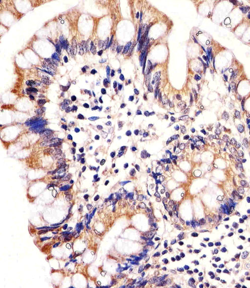 Immunohistochemical of paraffin-embedded H. colon section using CARD6 Antibody. Antibody was diluted at 1:25 dilution. A undiluted biotinylated goat polyvalent antibody was used as the secondary, followed by DAB staining.