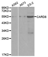 Western blot analysis of extracts of various cell lines, using CARD8 antibody.