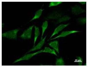 Immunofluorescent staining using CARD8 antibody. Immunostaining analysis in HeLa cells. HeLa cells were fixed with 4% paraformaldehyde and permeabilized with 0.01% Triton-X100 in PBS. The cells were immunostained with anti-CARD8 antibody.