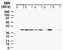 Western blot of TUCAN in five matched pairs of normal colonic mucosa (N) and colon carcinoma (T) using LS-C148306 at 1:2000. Specimens were normalized for total protein content. Each set of N and T is tissue lysate from the same patient.