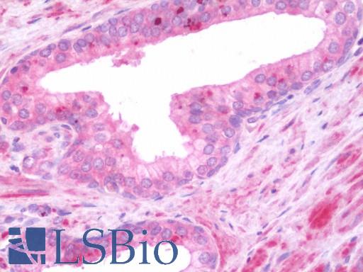 Human Prostate: Formalin-Fixed, Paraffin-Embedded (FFPE)