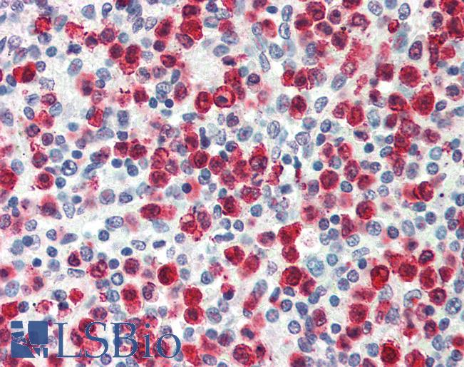 Anti-CARD8 antibody IHC of human spleen. Immunohistochemistry of formalin-fixed, paraffin-embedded tissue after heat-induced antigen retrieval. Antibody LS-B472 concentration 5 ug/ml.