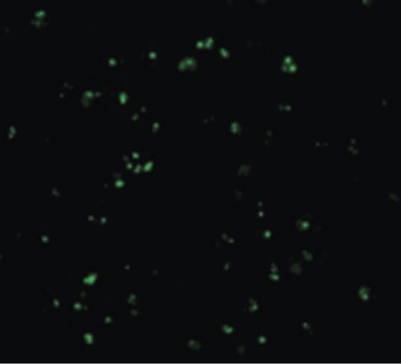 Immunofluorescence of CARD8 in K562 cells with CARD8 antibody at 20 ug/ml.