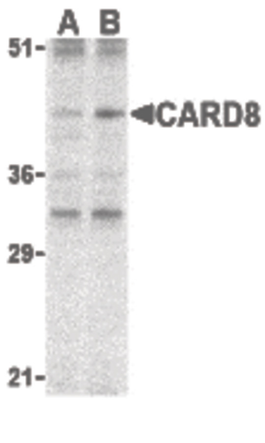 Western blot of CARD8 expression in K562 cell lysate with CARD8 antibody at (A) 2 and (B) 4 ug /ml.
