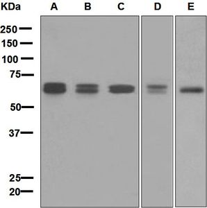 Western blot analysis on (A) K562, (B) U937, (C) HL-60, (D) HepG2, and (E) THP-1 cell lysates using anti-CARD9 antibody.