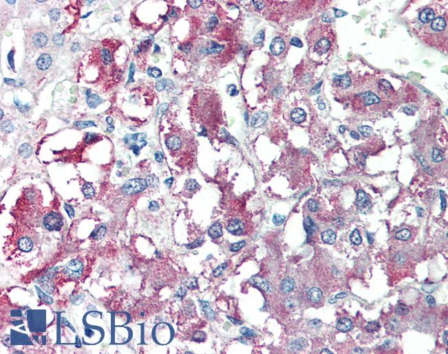 Anti-CARD9 antibody IHC of human adrenal. Immunohistochemistry of formalin-fixed, paraffin-embedded tissue after heat-induced antigen retrieval. Antibody LS-B473 concentration 10 ug/ml.