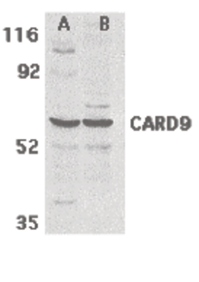 Western blot of CARD9 expression in human MDA-MB-361 (A) and PC-3 (B) cell lysate with CARD9 antibody at 2.5 ug /ml.