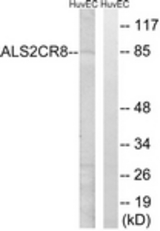 Western blot of extracts from HUVEC cells, using ALS2CR8 Antibody. The lane on the right is treated with the synthesized peptide.