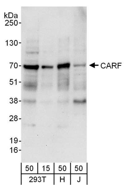 Detection of Human CARF by Western Blot. Samples: Whole cell lysate from 293T (15 and 50 ug), HeLa (H; 50 ug), and Jurkat (J; 50 ug) cells. Antibodies: Affinity purified rabbit anti-CARF antibody used for WB at 0.4 ug/ml. Detection: Chemiluminescence with an exposure time of 30 seconds.