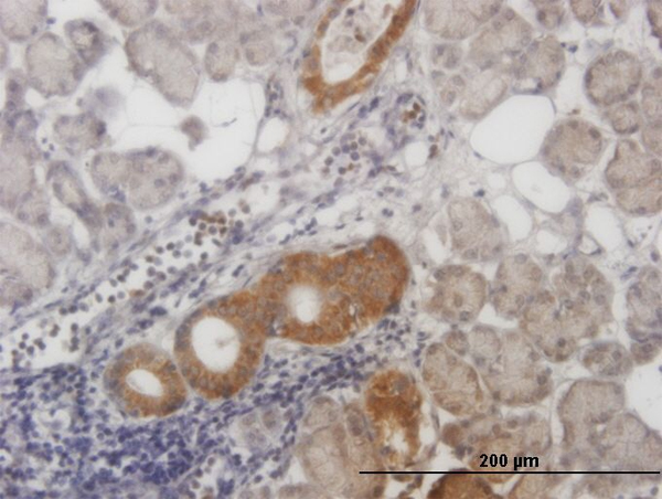 Immunoperoxidase of monoclonal antibody to ALS2CR8 on formalin-fixed paraffin-embedded human salivary gland. [antibody concentration 1 ug/ml]