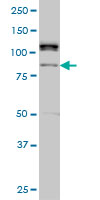 ALS2CR8 monoclonal antibody (M01), clone 2A3 Western blot of ALS2CR8 expression in HeLa NE.