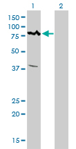 Western blot of ALS2CR8 expression in transfected 293T cell line by ALS2CR8 monoclonal antibody (M01), clone 2A3.