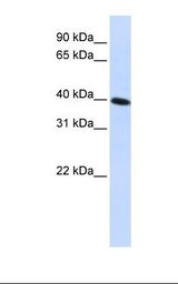 HepG2 cell lysate. Antibody concentration: 1.0 ug/ml. Gel concentration: 12%.