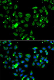 Immunofluorescence blot of A549 cell using CARD11 antibody. Blue: DAPI for nuclear staining.