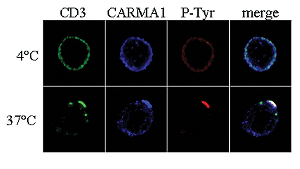 Immunocytochemistry analysis of CARMA1 using anti-CARMA1, pAb (AL220) . . Method: Human T cells (clone 6396p5.1.2) were incubated with anti-CD3, mAb for 20 min. on ice, followed by incubation with secondary goat anti-mouse for 15 min. at 4°C or 37°C. Cells were stained for CD3 (green), phosphotyrosine (red) and CARMA1 (1:200 dilution; blue) and analyzed by confocal microscopy.