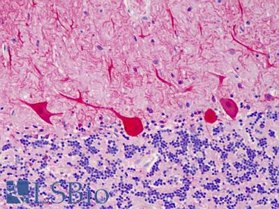 Anti-CARD11 antibody IHC of human cerebellum. Immunohistochemistry of formalin-fixed, paraffin-embedded tissue after heat-induced antigen retrieval. Antibody LS-B4794 concentration 10 ug/ml.