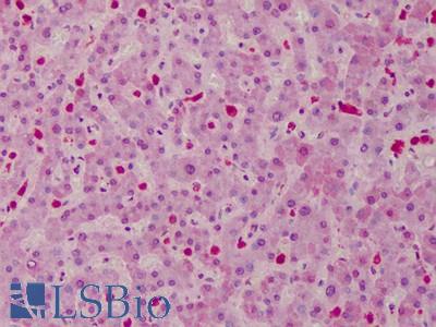Anti-CARD11 antibody IHC of human liver. Immunohistochemistry of formalin-fixed, paraffin-embedded tissue after heat-induced antigen retrieval. Antibody LS-B4794 concentration 10 ug/ml.