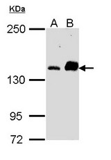Sample (30 ug of whole cell lysate). A: A431. B: Raji. 5% SDS PAGE. CARD11 antibody diluted at 1:1000.