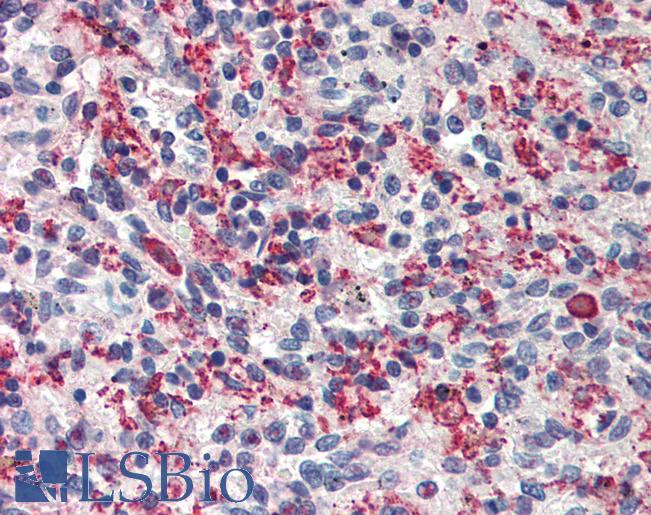 Anti-CARD11 antibody IHC of human spleen. Immunohistochemistry of formalin-fixed, paraffin-embedded tissue after heat-induced antigen retrieval. Antibody LS-B471 concentration 5 ug/ml.