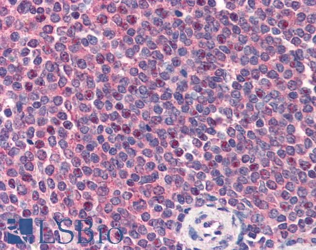 Anti-CARD11 antibody IHC of human spleen. Immunohistochemistry of formalin-fixed, paraffin-embedded tissue after heat-induced antigen retrieval. Antibody LS-B3030 concentration 2 ug/ml.