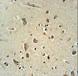 ATPGD1 antibody immunohistochemistry of formalin-fixed and paraffin-embedded human brain tissue followed by peroxidase-conjugated secondary antibody and DAB staining.
