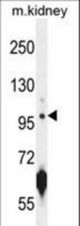ATPGD1 Antibody western blot of mouse kidney tissue lysates (35 ug/lane). The ATPGD1 antibody detected the ATPGD1 protein (arrow).