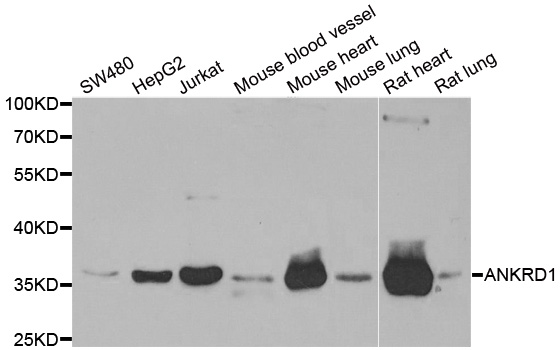 Western blot analysis of extracts of various cell lines, using ANKRD1 antibody.