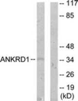 Western blot of extracts from COLO205 cells, using ANKRD1 Antibody. The lane on the right is treated with the synthesized peptide.