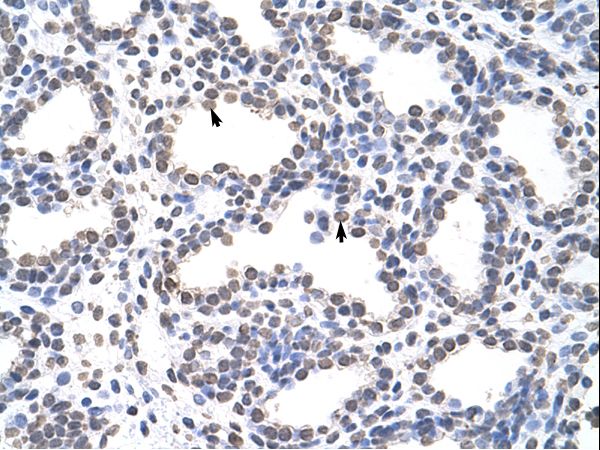 CARS antibody LS-C30358 was used in IHC to stain formalin-fixed, paraffin-embedded human lung.