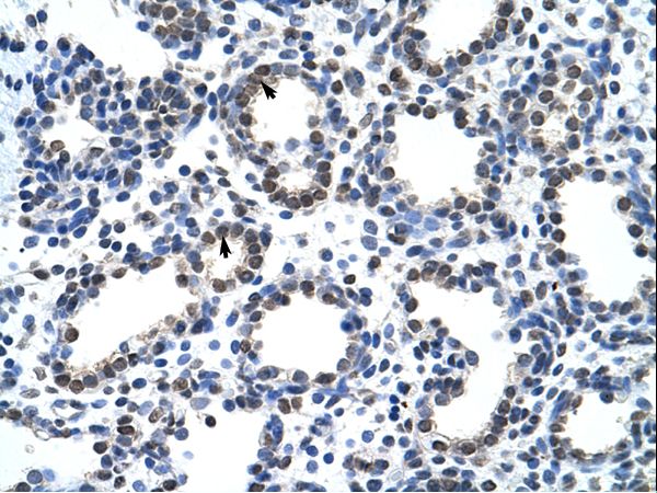 CARS antibody LS-C30359 was used in IHC to stain formalin-fixed, paraffin-embedded human lung.