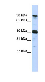 CARS antibody LS-C101832 Western blot of MCF7 cell lysate.