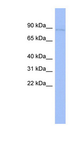 CARS antibody LS-C110502 Western blot of THP-1 cell lysate.