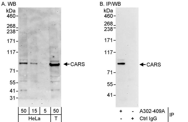 Detection of Human CARS by Western Blot and Immunoprecipitation. Samples: Whole cell lysate from HeLa (5, 15 and 50 ug for WB; 1 mg for IP, 20% of IP loaded) and 293T (T; 50 ug) cells. Antibodies: Affinity purified rabbit anti-CARS antibody used for WB at 0.4 ug/ml (A) and 1 ug/ml (B) and used for IP at 3 ug/mg lysate. Detection: Chemiluminescence with exposure times of 3 minutes (A) and 30 seconds (B).