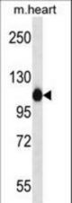 ACTN2 Antibody western blot of mouse heart tissue lysates (35 ug/lane). The ACTN2 antibody detected the ACTN2 protein (arrow).