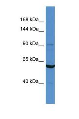 Western blot of Human Jurkat. CARS antibody dilution 1.0 ug/ml.