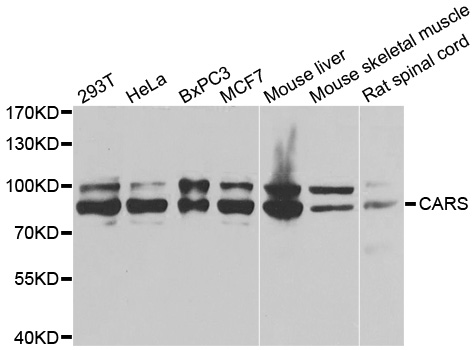 Western blot analysis of extracts of various cell lines, using CARS antibody.