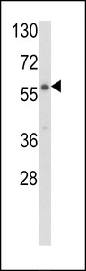Western blot of CARS2 Antibody in NCI-H460 cell line lysates (35 ug/lane). CARS2 (arrow) was detected using the purified antibody.