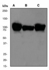 Western blot analysis on (A) Human skeletal muscle (B) rat heart (C) human heart lysate using anti-alpha-actinin 2 antibody (LS-C105281).