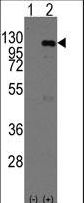Western blot of CASC3 (arrow) using rabbit polyclonal CASC3 Antibody (Mouse C-term). 293 cell lysates (2 ug/lane) either nontransfected (Lane 1) or transiently transfected with the CASC3 gene (Lane 2) (Origene Technologies).