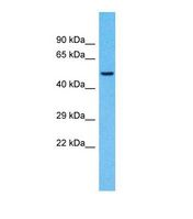 Western blot of Human Fetal Liver. CASC4 antibody dilution 1.0 ug/ml.