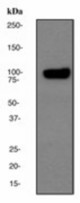 Western blot analysis on human skeletal muscle lysate using anti-Alpha-Actinin 2 antibody (LS-C105310), dilution 1:50000.