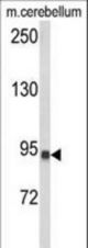 Western blot of CASD1 Antibody in mouse cerebellum tissue lysates (35 ug/lane). CASD1 (arrow) was detected using the purified antibody.