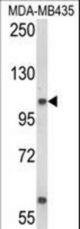 Western blot of CASD1 Antibody in MDA-MB435 cell line lysates (35 ug/lane). CASD1 (arrow) was detected using the purified antibody.
