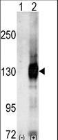 Western blot of CASK (arrow) using Cask Antibody. 293 cell lysates (2 ug/lane) either nontransfected (Lane 1) or transiently transfected with the CASK gene (Lane 2) (Origene Technologies).