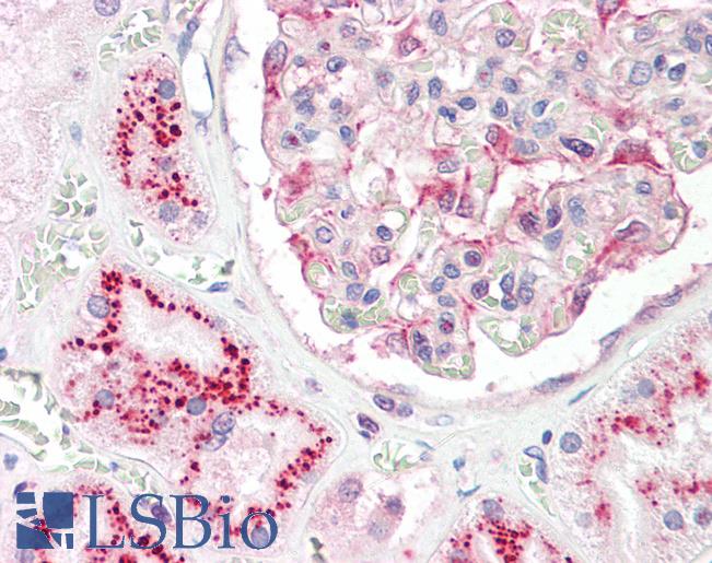Anti-CASK antibody IHC staining of human kidney. Immunohistochemistry of formalin-fixed, paraffin-embedded tissue after heat-induced antigen retrieval.