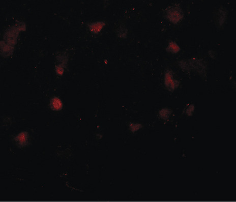 Immunofluorescence of CASK in human brain tissue with CASK antibody at 20 ug/ml.