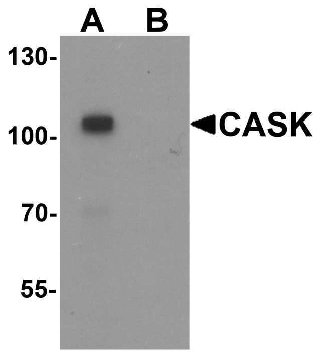 Western blot analysis of CASK in mouse brain tissue lysate with CASK antibody at 1 ug/ml in (A) the absence and (B) the presence of blocking peptide.